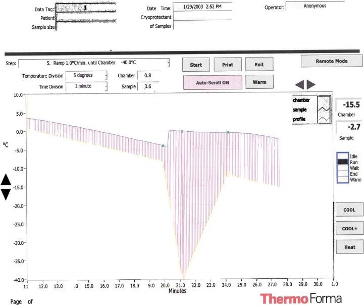 TF Graph